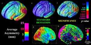 brain-activity-zonas-loni.ucla.edu